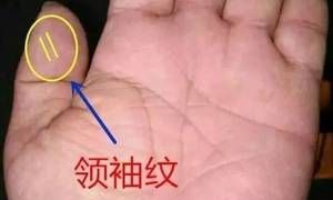 童子命精神病抑郁强迫
,童子命图3