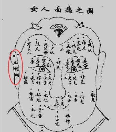 女人10处有痣是富贵痣
,女人有钱有地位的痣图10