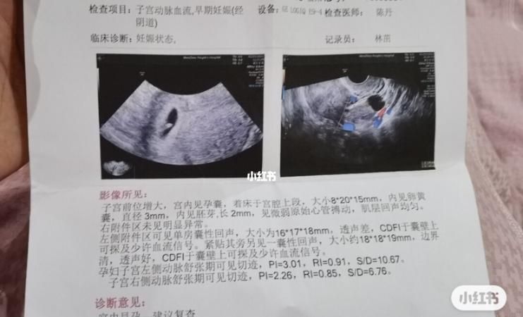 6一7周孕囊大小看男女
,根据四维彩超的数据怎么区分男孩女孩图3