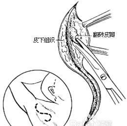 为什么把狐臭叫做门户
,...巴彦淖尔市附近人们说的“门户”是什么意思我也不知道是不是这两...图1