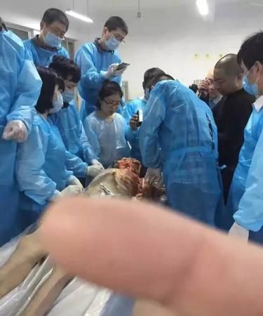 中医认为总梦到死人的原因
,经常梦见死人中医辨证图2