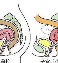 子宫后位每次都怀女宝,子宫前后位和生男生女有关系吗图1